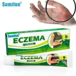 Eczema Cream | Dermatitis, Psoriasis & Anti-Itch Antibacterial Treatment