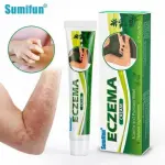 Eczema Cream | Dermatitis, Psoriasis & Anti-Itch Antibacterial Treatment