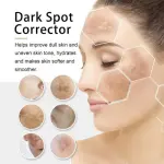 EELHOE Dark Spot Corrector – Skin Brightening Serum for Pigmentation, Acne Marks & Uneven Tone