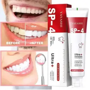 SP-4 Probiotics Whitening Toothpaste – Teeth Whitening & Gum Health