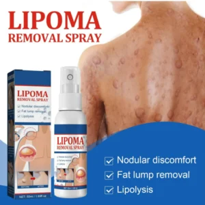 Lipoma Removal Cream 20g, Lipoma Removal Cream Ointment, Lipoma Elimination Cream