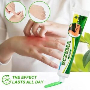 Eczema Cream Dermatitis Psoriasis Antibacterial Skin Care Ointment Treat Rash Urticaria Anti Itching Medical Plaster