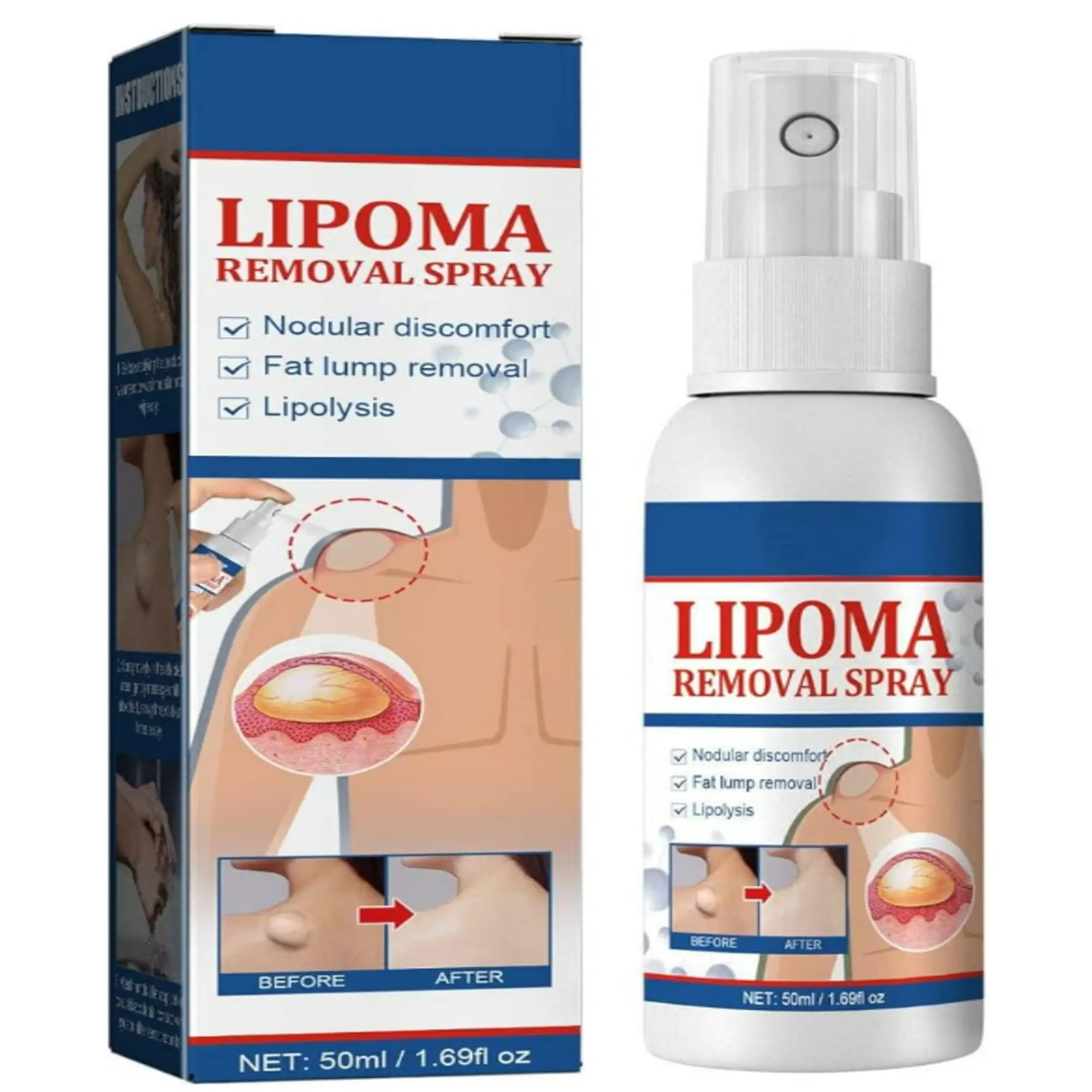 1-1-3.webp Lipoma Removal Cream 20g, Lipoma Removal Cream Ointment, Lipoma Elimination Cream - Image 1