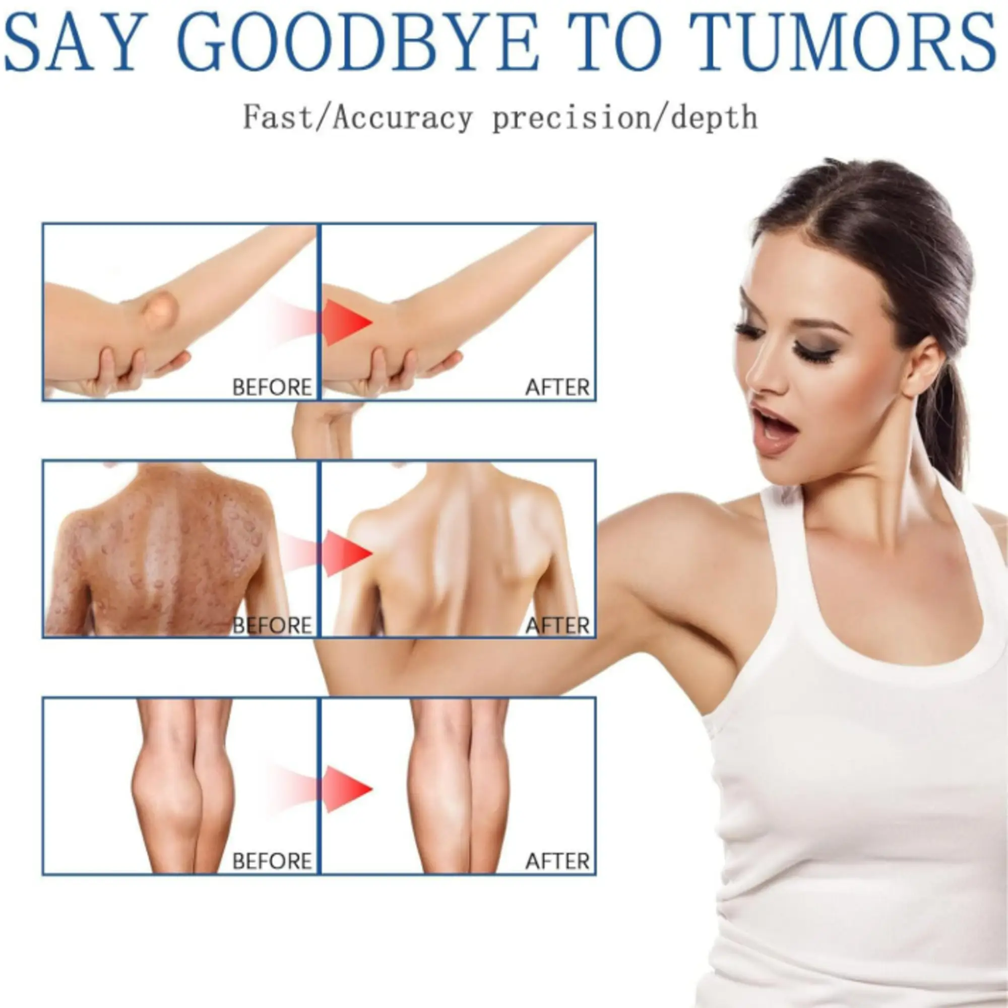 6-1-3.webp Lipoma Removal Cream 20g, Lipoma Removal Cream Ointment, Lipoma Elimination Cream - Image 5